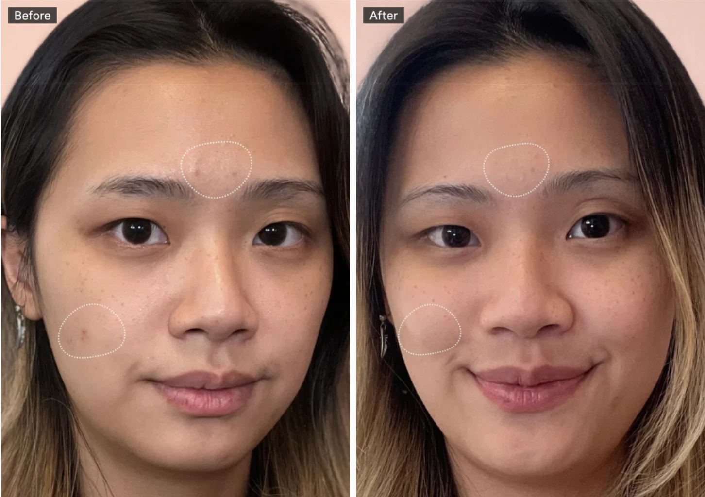 Before and after skin results from a Kate Somerville creator